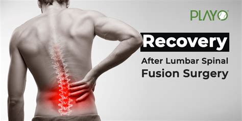 After A Lumbar Spinal Fusion Surgery, Here Is How You Recover | Playo