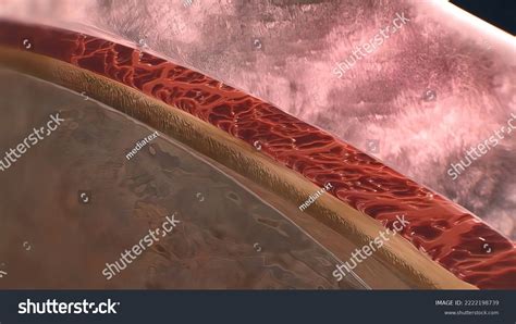 Uveitis Inflammation Part All Uvea Eye Stock Illustration 2222198739 ...