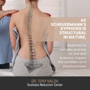 Kyphosis Treatment: Is Kyphosis Reversible Or Treatable?