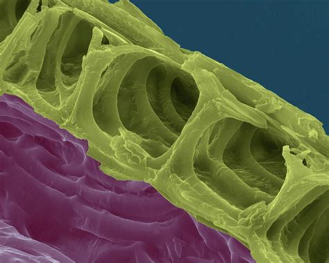 Plant Cell Wall Microscope Image - Micropedia