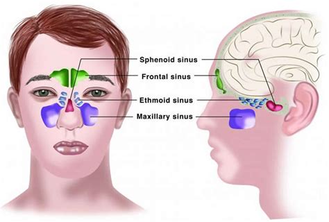 Catarrh definition, causes, symptoms, diagnosis & treatment