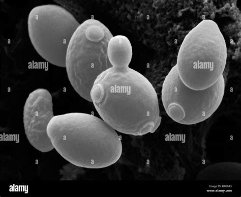 Saccharomyces Cerevisiae Yeast