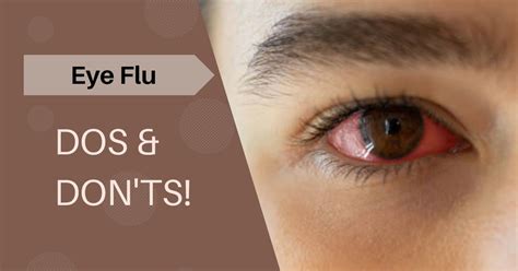 Eye Flu outbreak! What Should You Avoid? Dos & Don'ts! - Jaipur Stuff