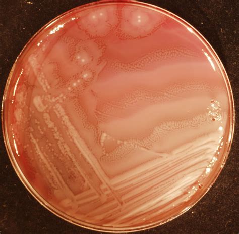 Proteus Mirabilis On Blood Agar