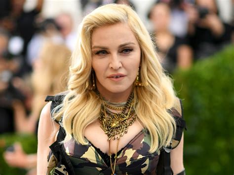 Madonna Jokes About 'swelling From Surgery' After Grammys Backlash ...