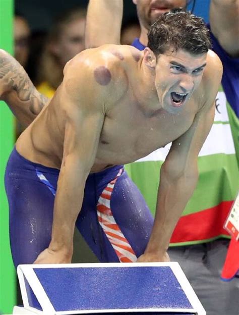 Giant 'love bite' marks help Michael Phelps claim 19th Olympic gold ...