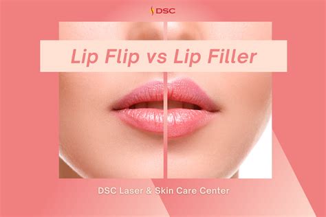 Lip Flip vs Lip Filler - DSC Laser & Skin Care Center