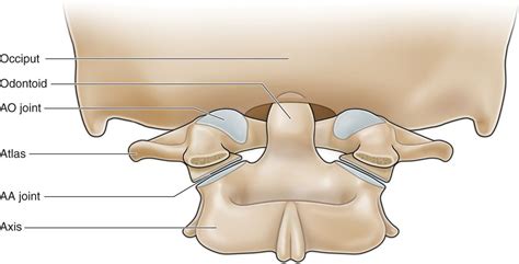 Atlanto-Occipital Joint Injections | Anesthesia Key