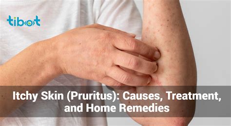 Itchy Skin (Pruritus): Causes, Treatment, and Home Remedies