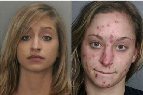 The Top 10 Worst Meth Transformations