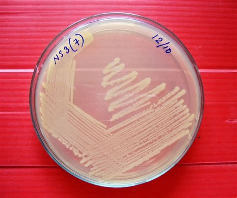 What is the Difference Between Auxotroph and Prototroph - Pediaa.Com