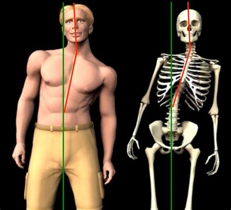 The Development, Evaluation and Treatment of Musculoskeletal Disorders ...