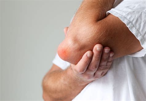 What Does Elbow Bursitis Look & Feel Like? | Philadelphia Hand to Shoulder