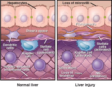 Figure 1 from Kupffer cells in the liver. | Semantic Scholar