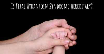 What is the history of Fetal Hydantoin Syndrome?