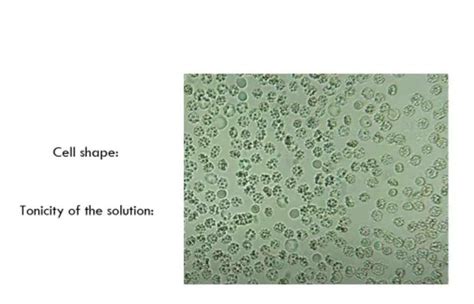 Solved Cell shape:Tonicity of the solution: | Chegg.com