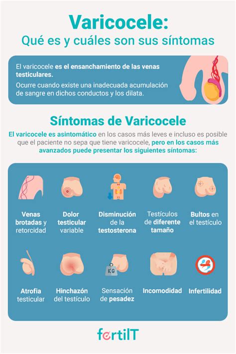 Varicocele Radiology