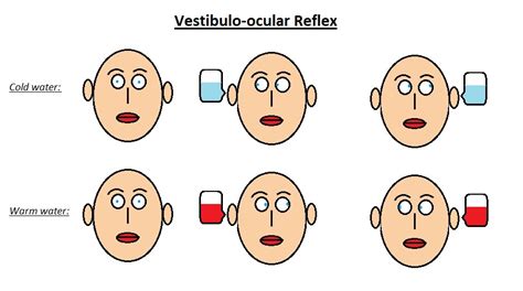 Brainstem Reflexes - WikiLectures