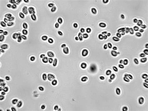 Saccharomyces Cerevisiae Yeast Cells Under Microscope - Micropedia