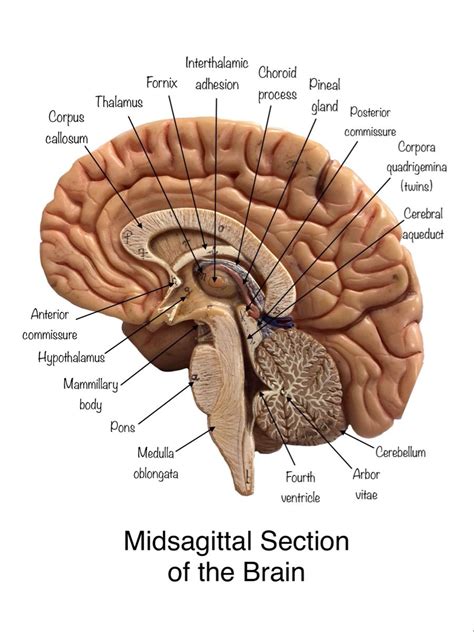 Midsagittal section of the brain | Human brain anatomy, Brain anatomy ...