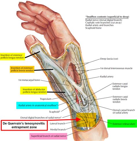 De Quervain’s Tenosynovitis - Causes, Symptoms, Test, Exercise, Surgery