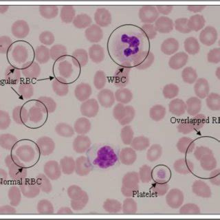 RBC counting and classification flow diagram. | Download Scientific Diagram