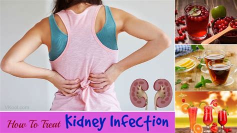 How to treat kidney infection naturally at home – 15 tips