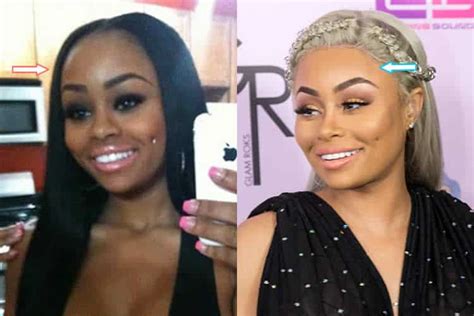 Did Black Chyna Have Plastic Surgery? (Before & After 2021)