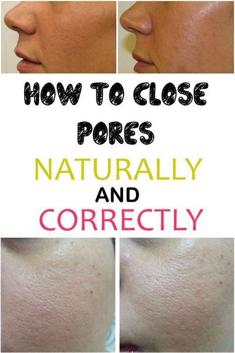 How to close pores naturally and correctly #getridofporestheeasyway ...