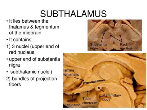 PPT - DIENCEPHALON Thalamus & Hypothalamus PowerPoint Presentation - ID ...