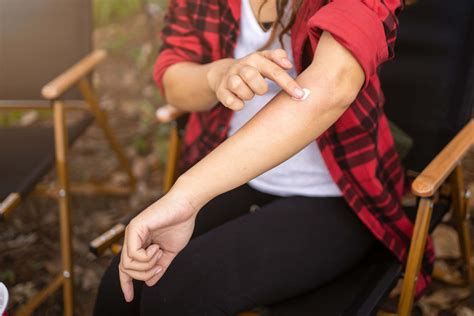 The Difference Between No-See-Um Bites vs. Mosquito Bites – The ...