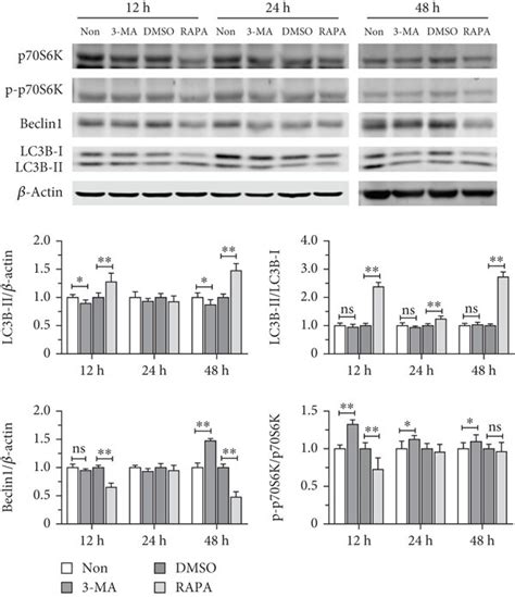 Effects of autophagy activation and inhibition on autophagy-related ...