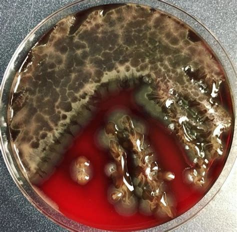 What a Pseudomonas aeruginosa 😮! This... - Elmicrobiologist