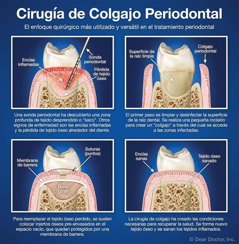 Patient Education | Austin, TX Dentist - Advanced Smiles Dental, P.A.