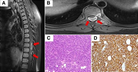 Representative post-contrast T1-weighted MRI images in sagittal (a) and ...