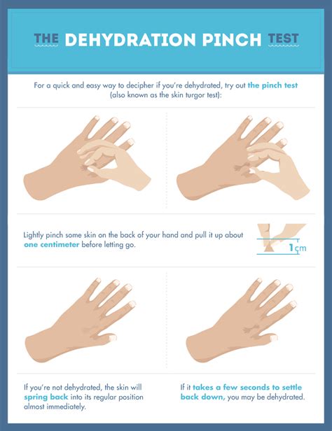 How To Check For Skin Turgor - Warselection