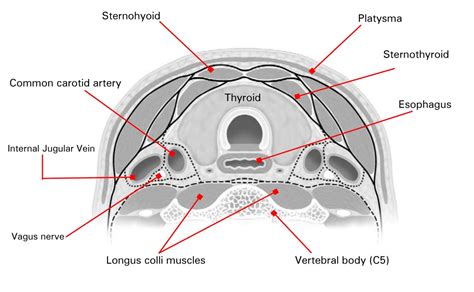 Thyroid Ultrasound