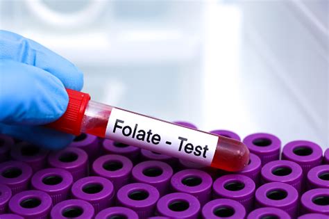 Folate Test To Look For Abnormalities From Blood Stock Photo - Download ...