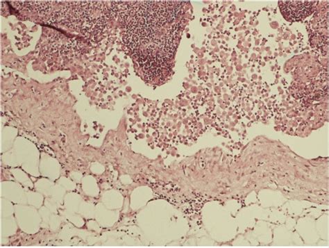 Mesothelial Cells Histology