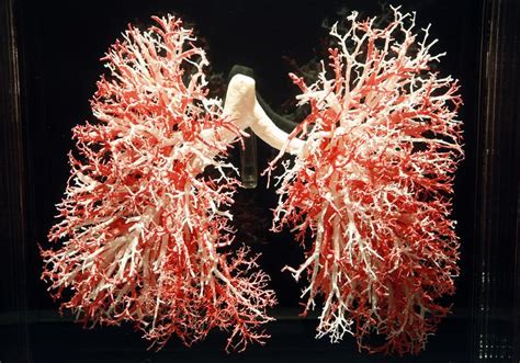 the lungs are red and white in this photo, it looks like they have been ...