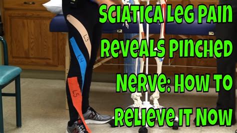 Sciatica Leg Pain Reveals Pinched Nerve: How to Relieve It Now