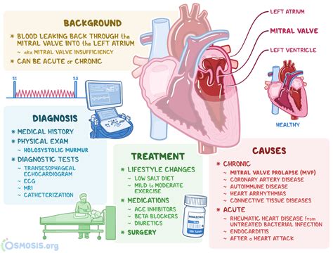 Mitral Valve Prolapse