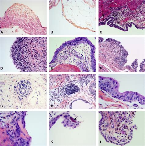 Membrane Histology