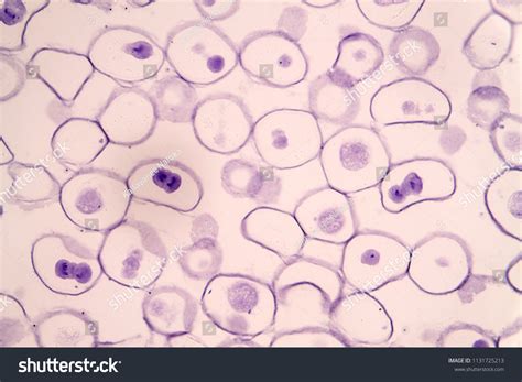 Meiosis Animal Cell Under Microscope EducationẢnh có sẵn1131725213 ...