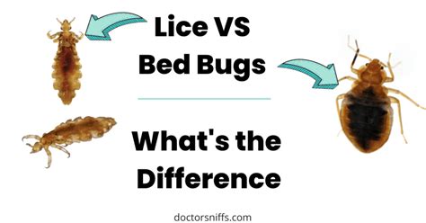 Lice vs Bed Bugs - Ultimate Guide with Photos