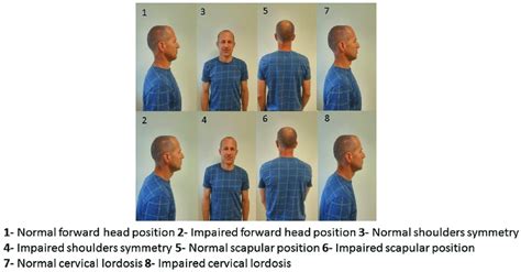 Neck & shoulders posture. | Download Scientific Diagram