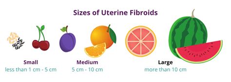 Uterus Fibroid Size Chart In Mm - Best Picture Of Chart Anyimage.Org