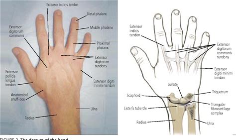 Figure 2 from Hand and wrist injuries: Part I. Nonemergent evaluation ...