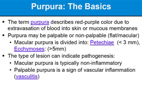 Ecchymosis Vs Petechiae