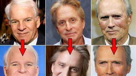 Steve Martin, Simon Cowell, & More Male Celebs Who May Have Had Plastic ...